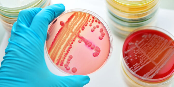 台美檢驗抗菌菌種清單一欄表(基礎)